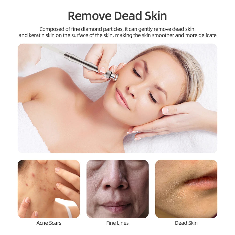 Foreverlily Professional Diamond Microdermabrasion Machine for Skin Care